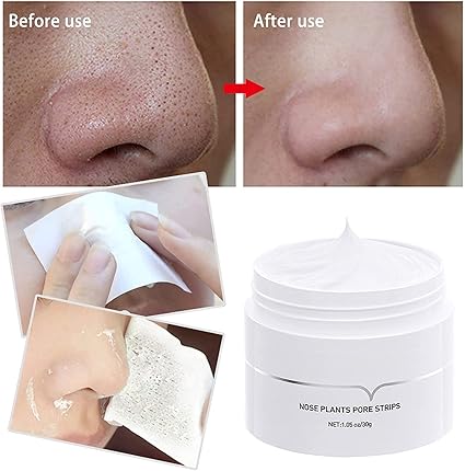 DermaClean™ Mascarilla dermatológica limpiadora de poros - Limpieza facial profunda✨HOY CON 50% DCTO